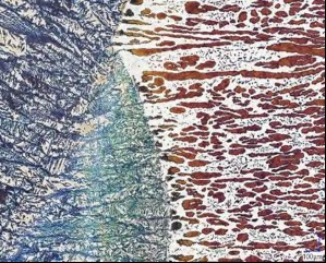 Microscopic image of duplex stainless steel composition showing austenite and ferrite phases
